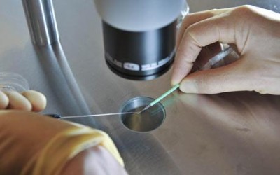 IVF (In-Vitro Fertilization)