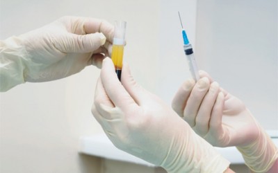 Pain relief & treatments for Arthritis