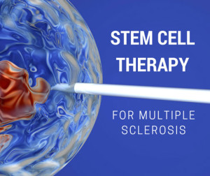 stem-cell-therapy-for-multiple-sclerosis